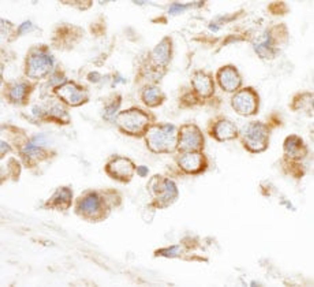 Detection of human CNOT3 by immunohistochemistry.