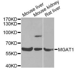 Western blot - MGAT1 antibody (A6387)