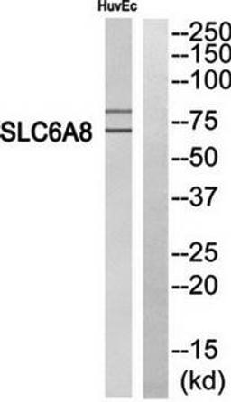 Western blot analysis of extracts from HuvEc cells using SLC6A8 antibody