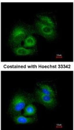 Immunocytochemistry/Immunofluorescence: Sirtuin 3/SIRT3 Antibody [NBP1-31029] -  Analysis of methanol-fixed A549, using antibody at 1:200 dilution.