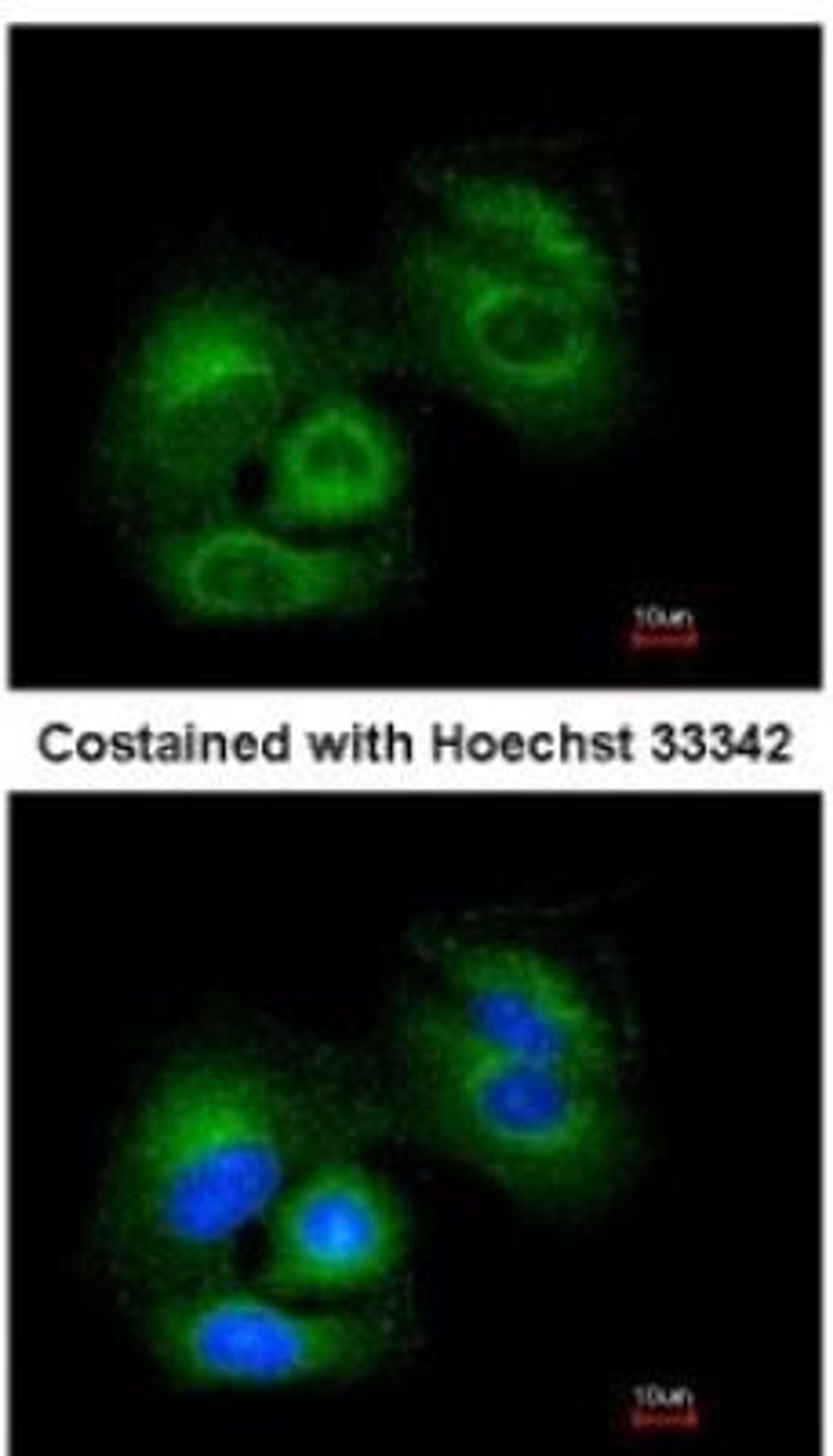 Immunocytochemistry/Immunofluorescence: Sirtuin 3/SIRT3 Antibody [NBP1-31029] -  Analysis of methanol-fixed A549, using antibody at 1:200 dilution.