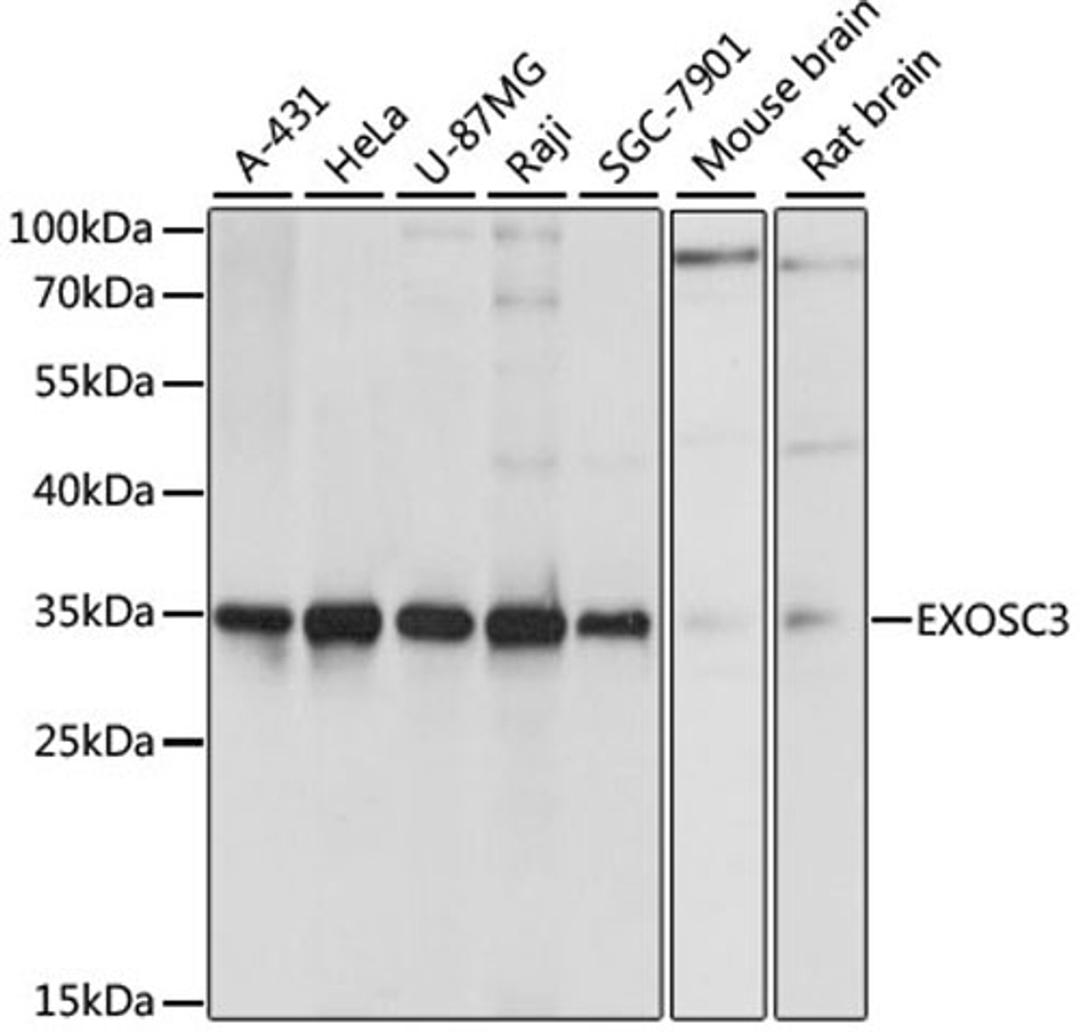 Western blot - EXOSC3 antibody (A11623)