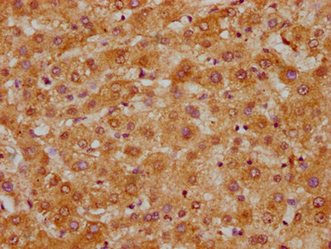 IHC image of CSB-PA021438EA01HU diluted at 1:300 and staining in paraffin-embedded human liver tissue performed on a Leica BondTM system. After dewaxing and hydration, antigen retrieval was mediated by high pressure in a citrate buffer (pH 6.0). Section was blocked with 10% normal goat serum 30min at RT. Then primary antibody (1% BSA) was incubated at 4&deg;C overnight. The primary is detected by a biotinylated secondary antibody and visualized using an HRP conjugated SP system.