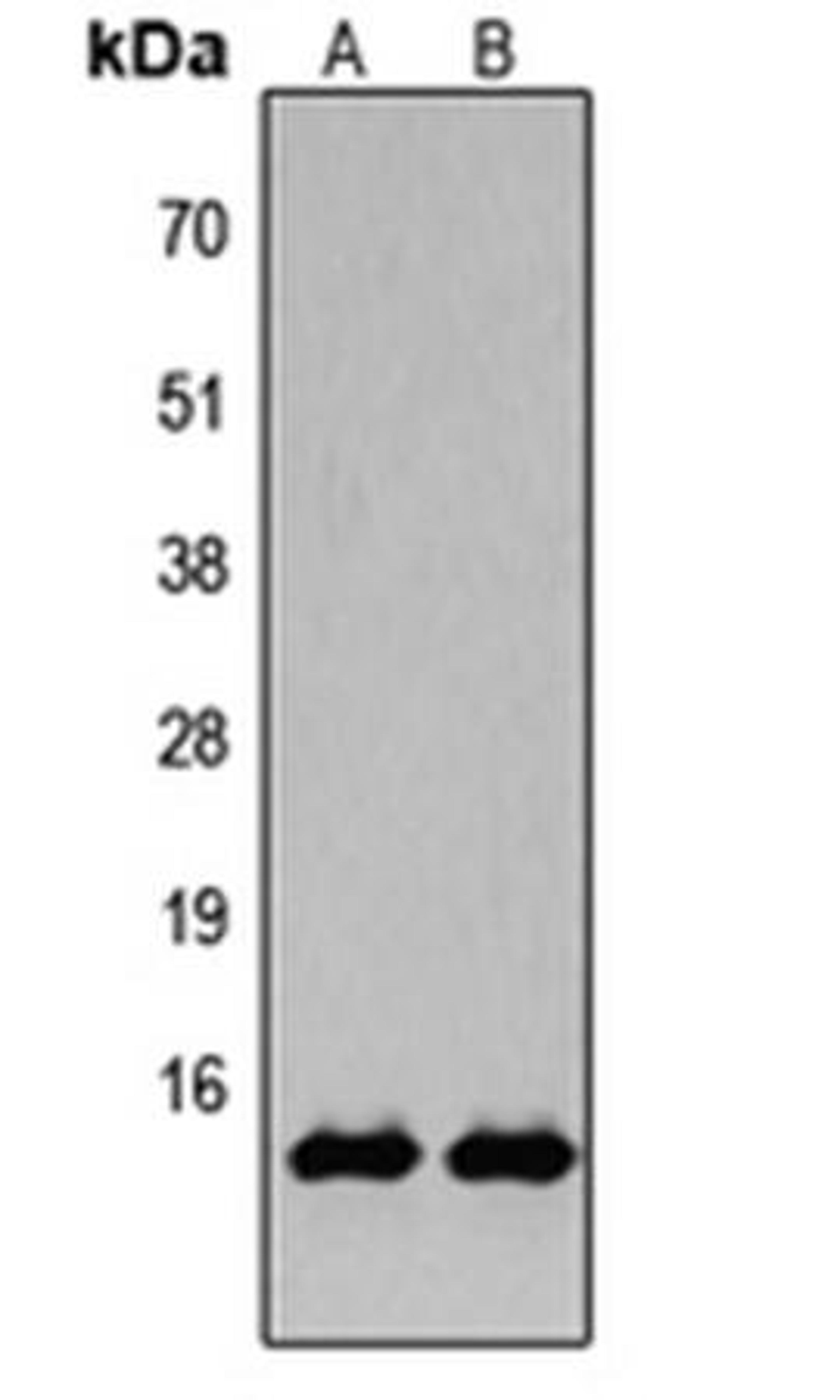 Western blot analysis of HeLa TSA-treated (Lane1), NIH3T3 TSA-treated (Lane2) whole cell using Histone H2B (AcK15) antibody