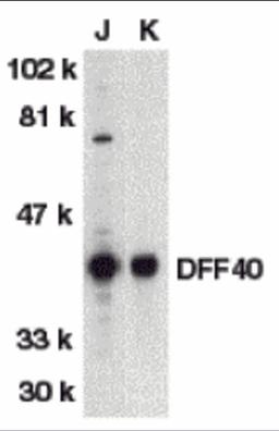 Western blot analysis of DFF40 in Jurkat (J) and K562 (K) whole cell lysate with DFF40 antibody at 1:500 dilution.