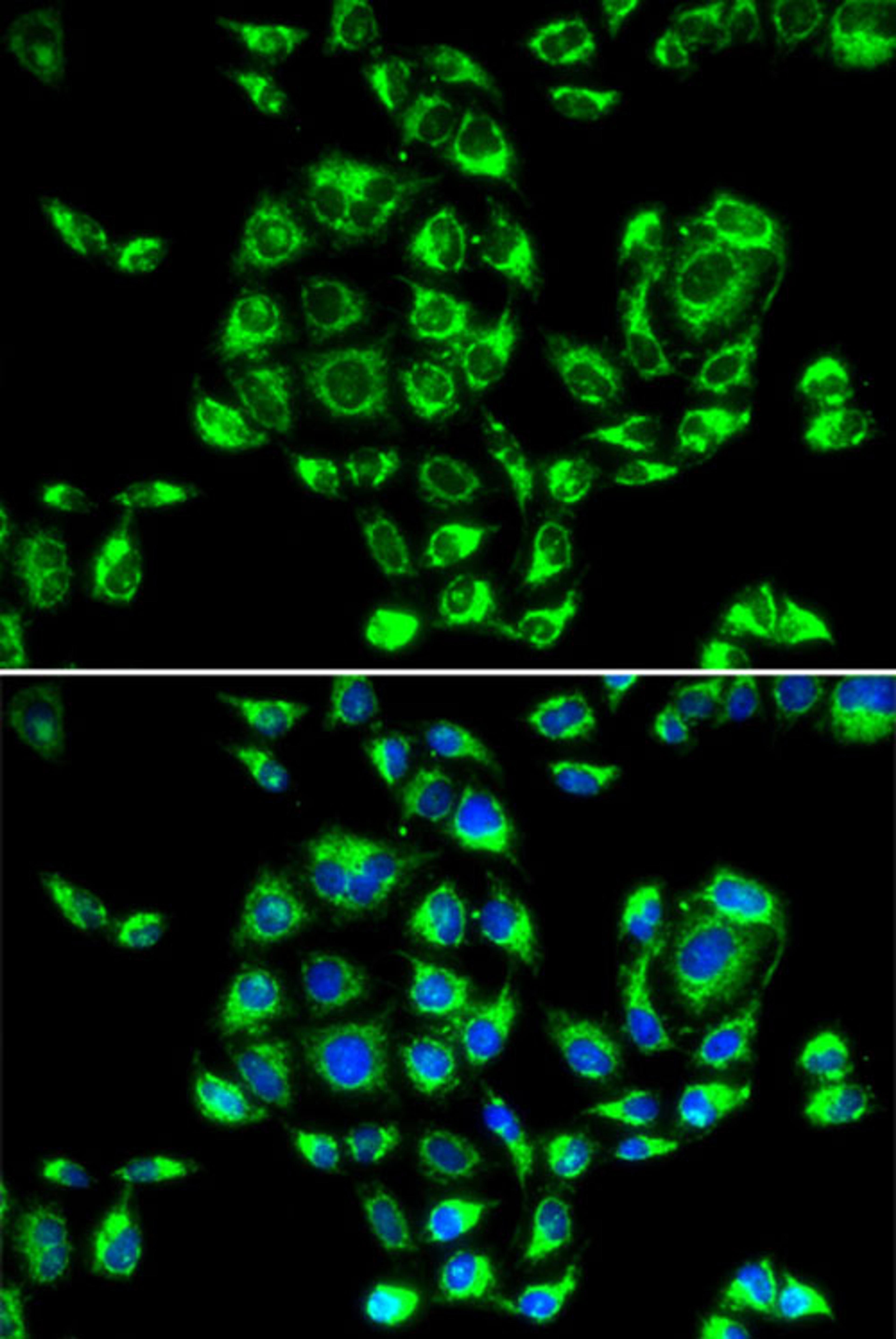 Immunofluorescence - RPS16 antibody (A6976)