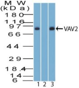 Western Blot: VAV2 Antibody [NBP2-27078] - analysis of VAV2. Jurkat lysate in the 1) absence and 2) presence of immunizing peptide, and 3) K562 lysate probed with 3 ug/ml of VAV2 antibody. Goat anti-rabbit Ig HRP secondary antibody and PicoTect ECL substrate solution were used for this test.