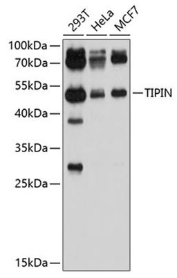 Western blot - TIPIN antibody (A10344)