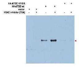 Western blot analysis of transfected 293T cells. using ATDC Ac-K116 antibody