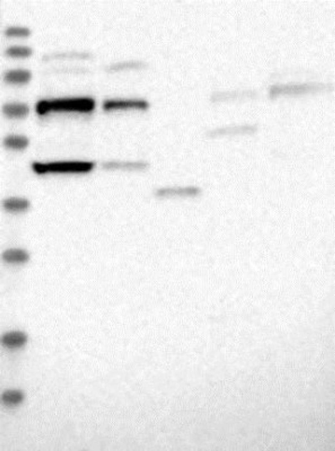 Western Blot: TDRD5 Antibody [NBP1-81971] - Lane 1: Marker [kDa] 230, 130, 95, 72, 56, 36, 28, 17, 11<br/>Lane 2: RT-4<br/>Lane 3: U-251 MG<br/>Lane 4: Human Plasma<br/>Lane 5: Liver<br/>Lane 6: Tonsil