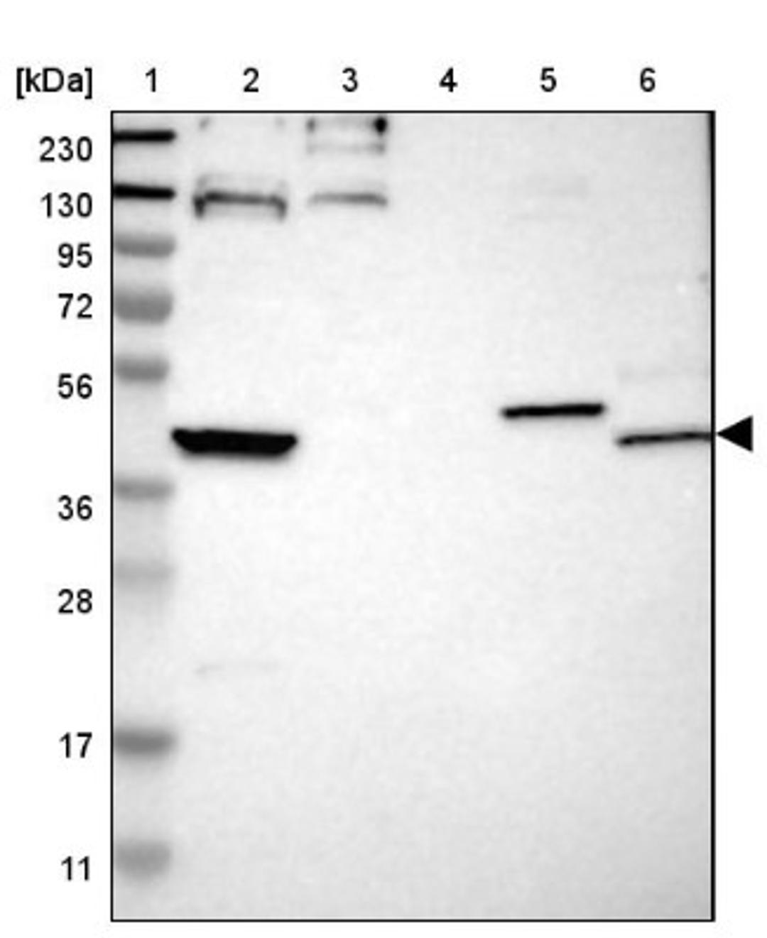 Western Blot: FUT2 Antibody [NBP1-80775] - Lane 1: Marker [kDa] 230, 130, 95, 72, 56, 36, 28, 17, 11<br/>Lane 2: Human cell line RT-4<br/>Lane 3: Human cell line U-251MG sp<br/>Lane 4: Human plasma (IgG/HSA depleted)<br/>Lane 5: Human liver tissue<br/>Lane 6: Human liver tissue