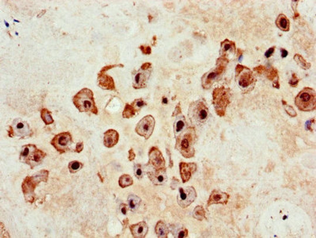 Immunohistochemistry of paraffin-embedded human placenta tissue using CSB-PA618877LA01HU at dilution of 1:100