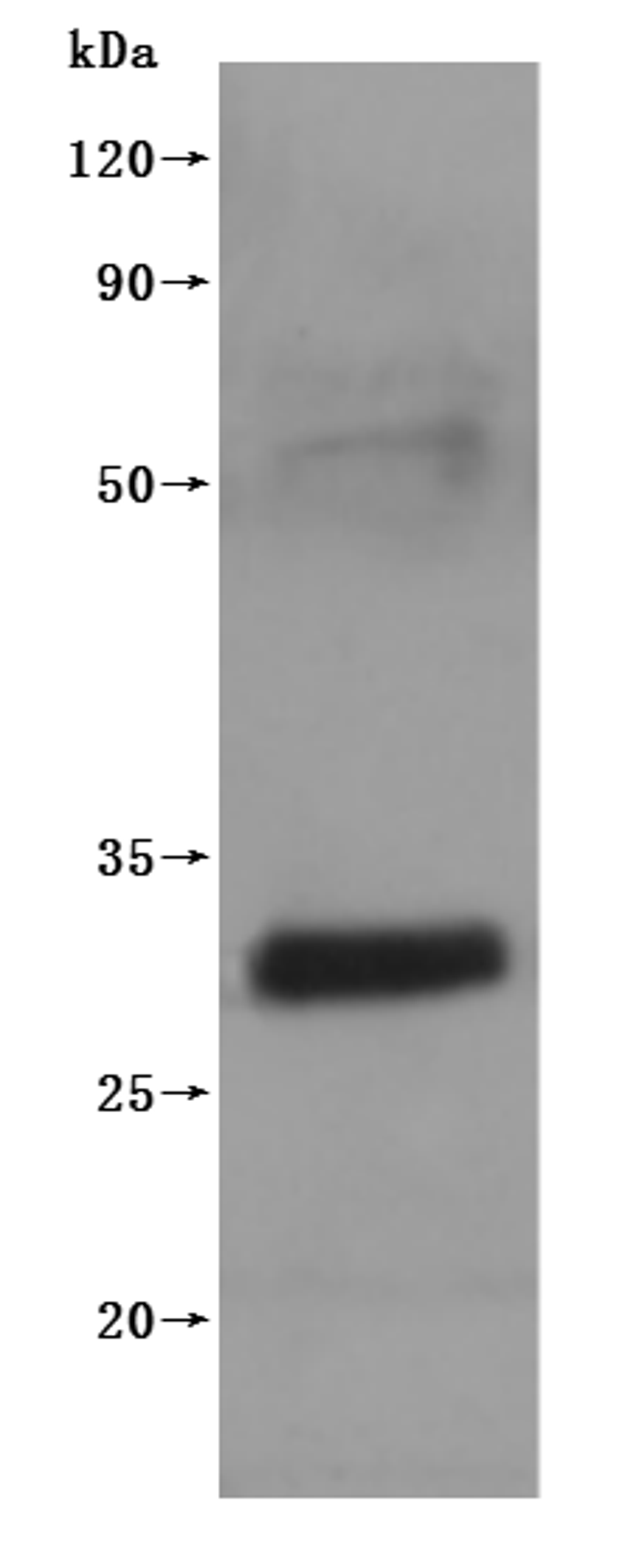 CSB-MP005498MO(F3) is detected by Mouse anti-6*His monoclonal antibody.