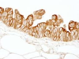 Detection of human HPIP by immunohistochemistry.