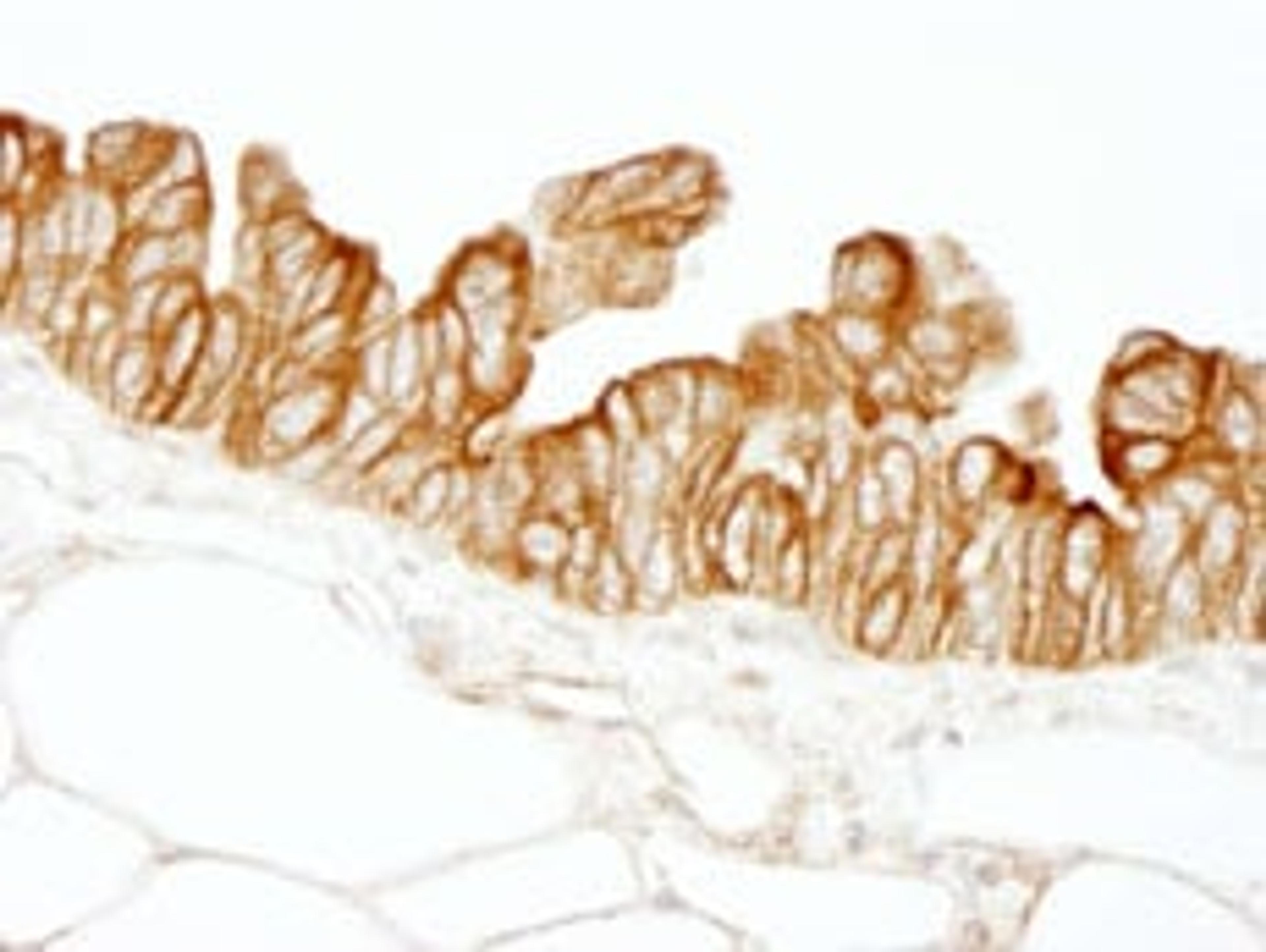 Detection of human HPIP by immunohistochemistry.