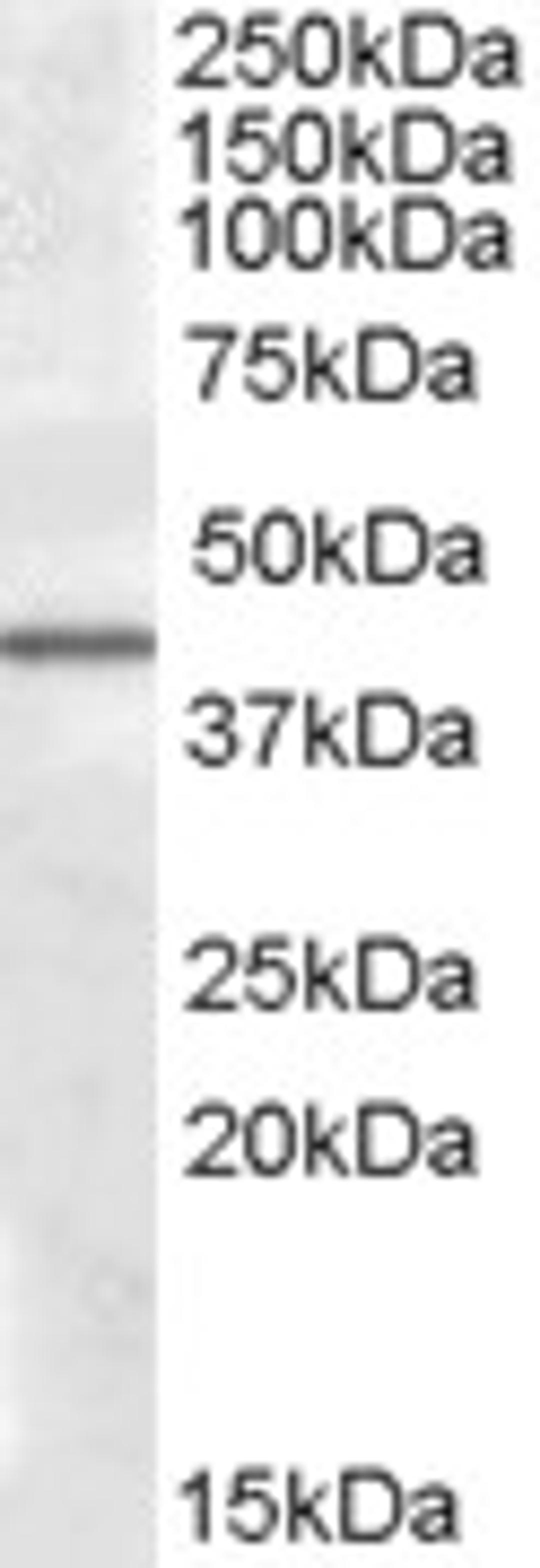 46-925 (0.5ug/ml) staining of Human Liver lysate (35ug protein in RIPA buffer). Primary incubation was 1 hour. Detected by chemiluminescence.