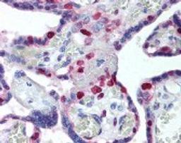 Immunohistochemistry staining of PCNA in placenta tissue using PCNA monoclonal Antibody.