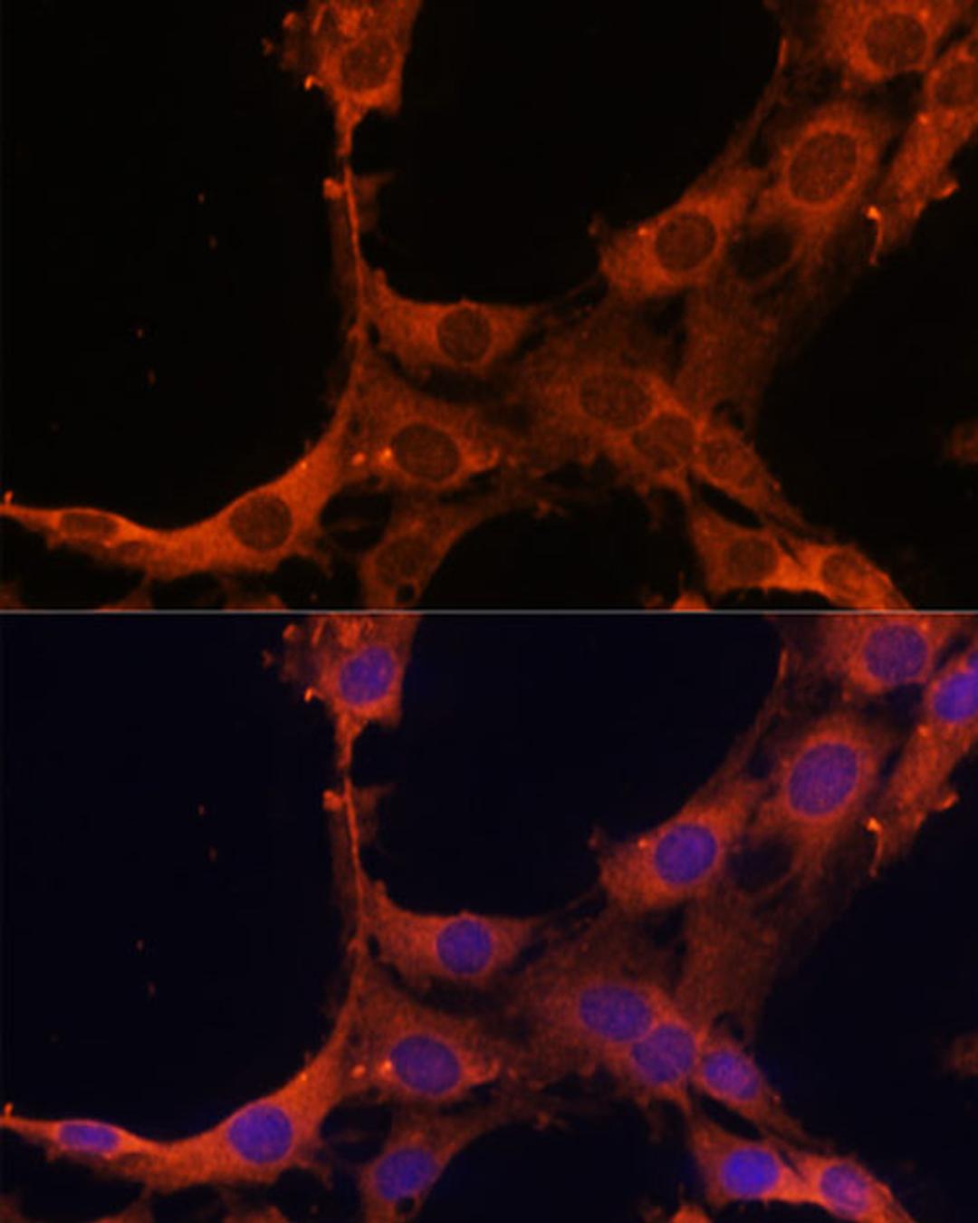 Immunofluorescence - Smad2 antibody (A16912)