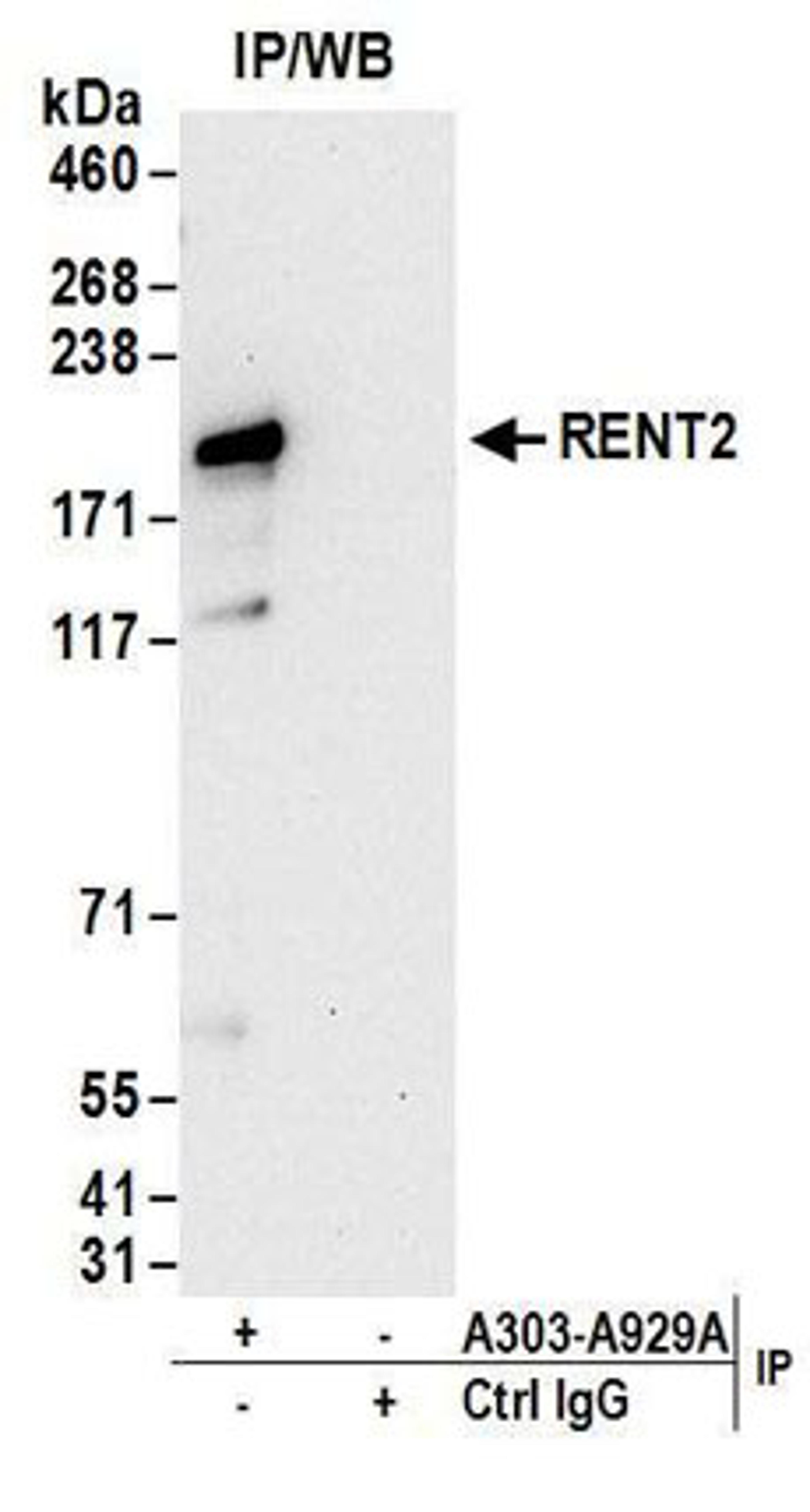 Detection of human RENT2 by western blot of immunoprecipitates.