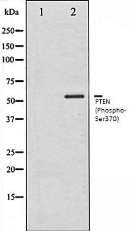 Western blot analysis of HeLa whole cell lysates using PTEN (Phospho-Ser370) antibody, The lane on the left is treated with the antigen-specific peptide.