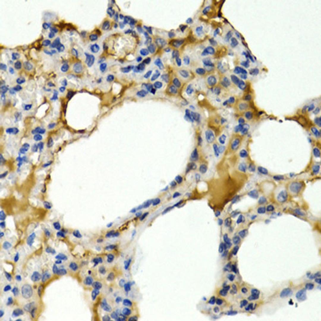 Immunohistochemistry  - IL9 antibody (A1894)