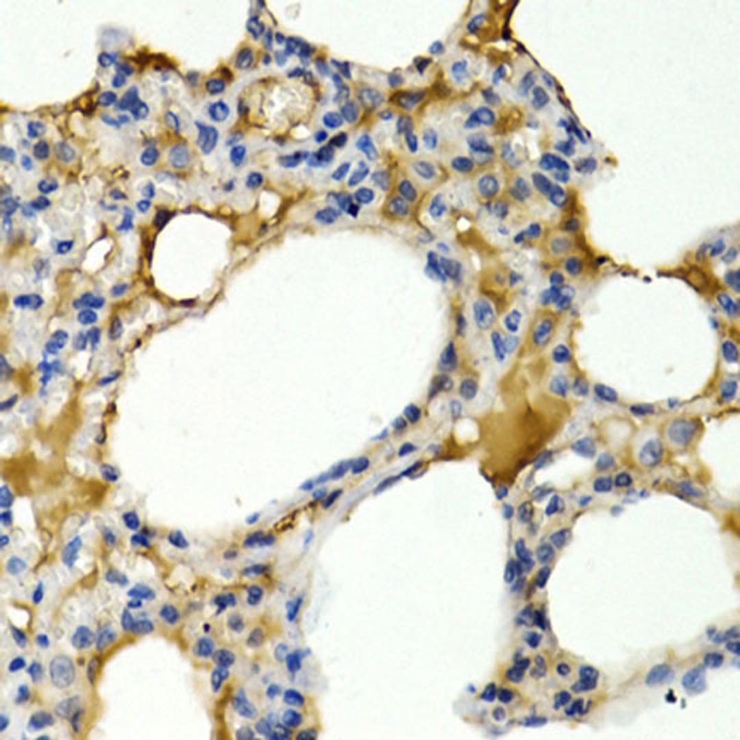 Immunohistochemistry - IL9 antibody (A1894)