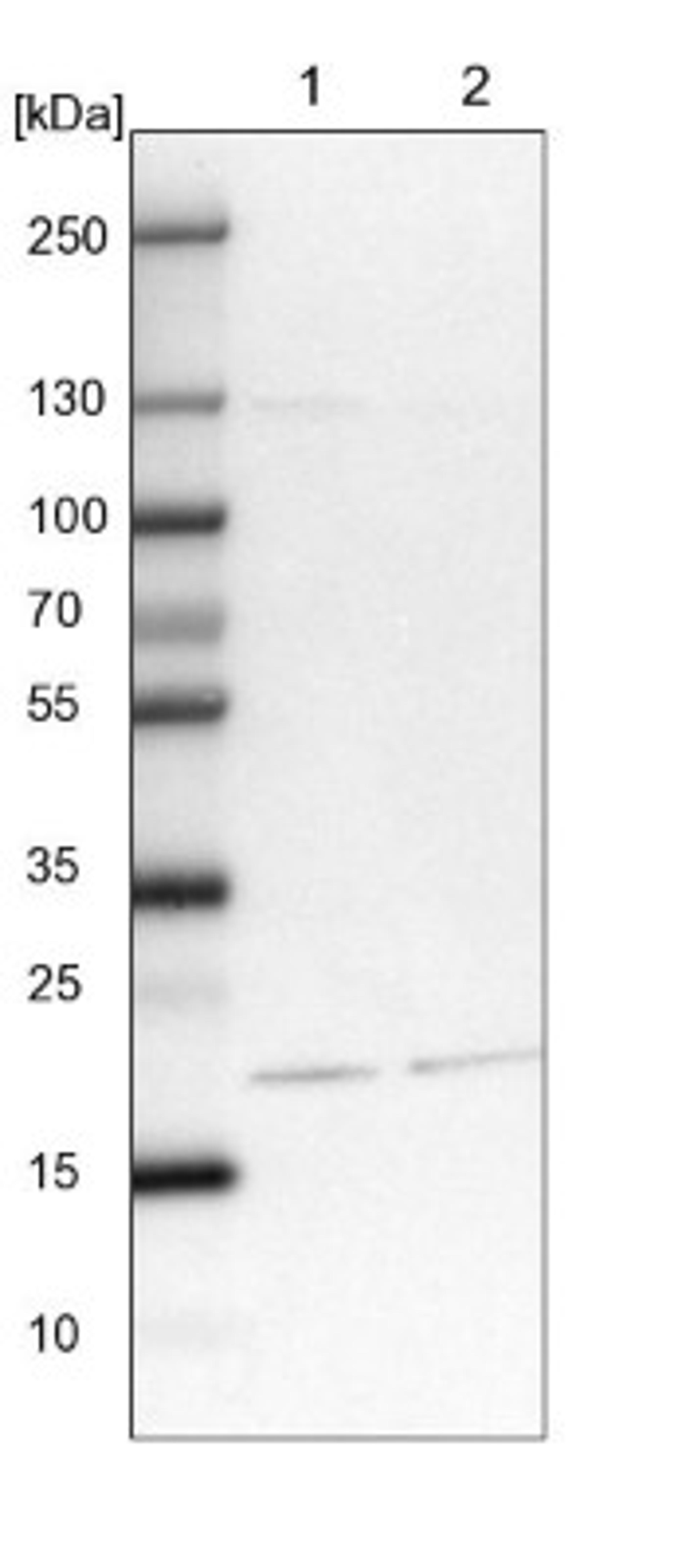 Western Blot: CRYBB3 Antibody [NBP1-91813] - Lane 1: NIH-3T3 cell lysate (Mouse embryonic fibroblast cells)<br/>Lane 2: NBT-II cell lysate (Rat Wistar bladder tumour cells)