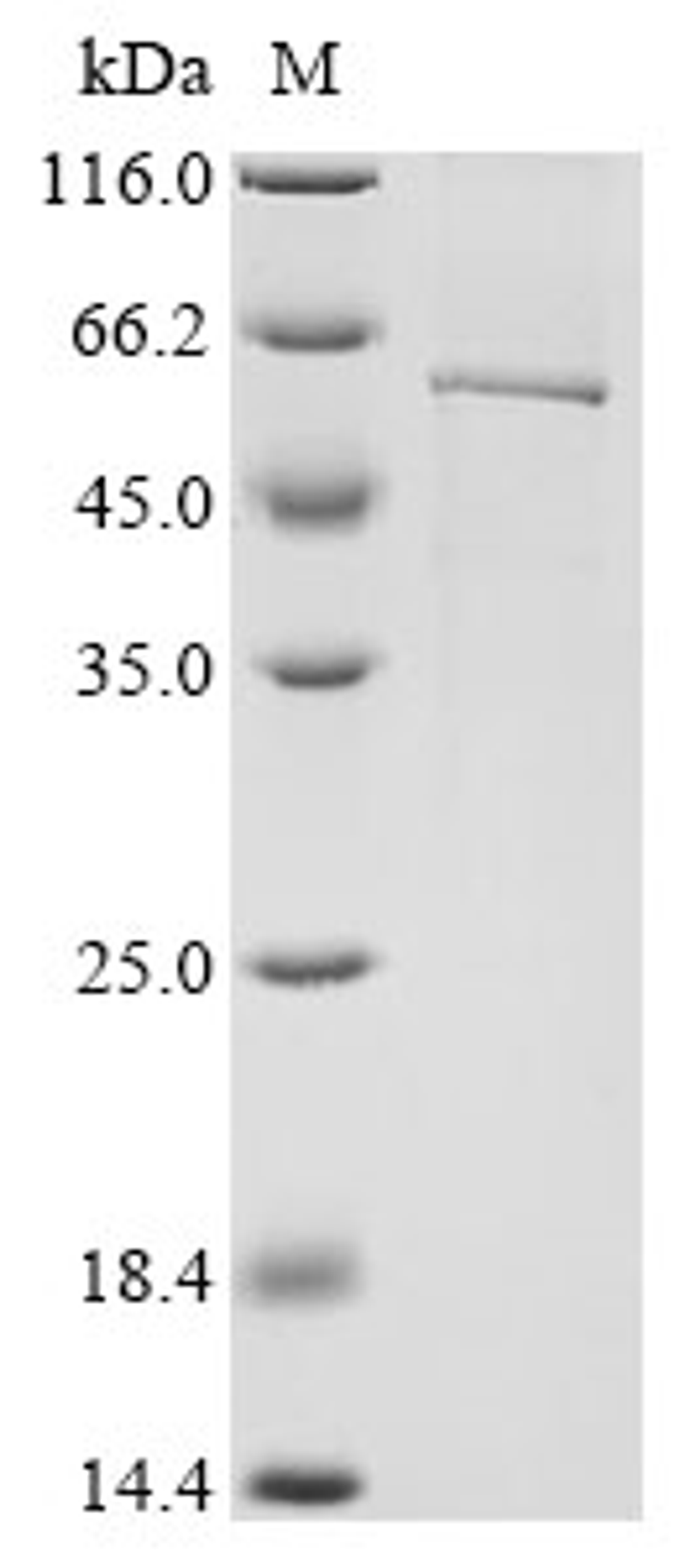 (Tris-Glycine gel) Discontinuous SDS-PAGE (reduced) with 5% enrichment gel and 15% separation gel.