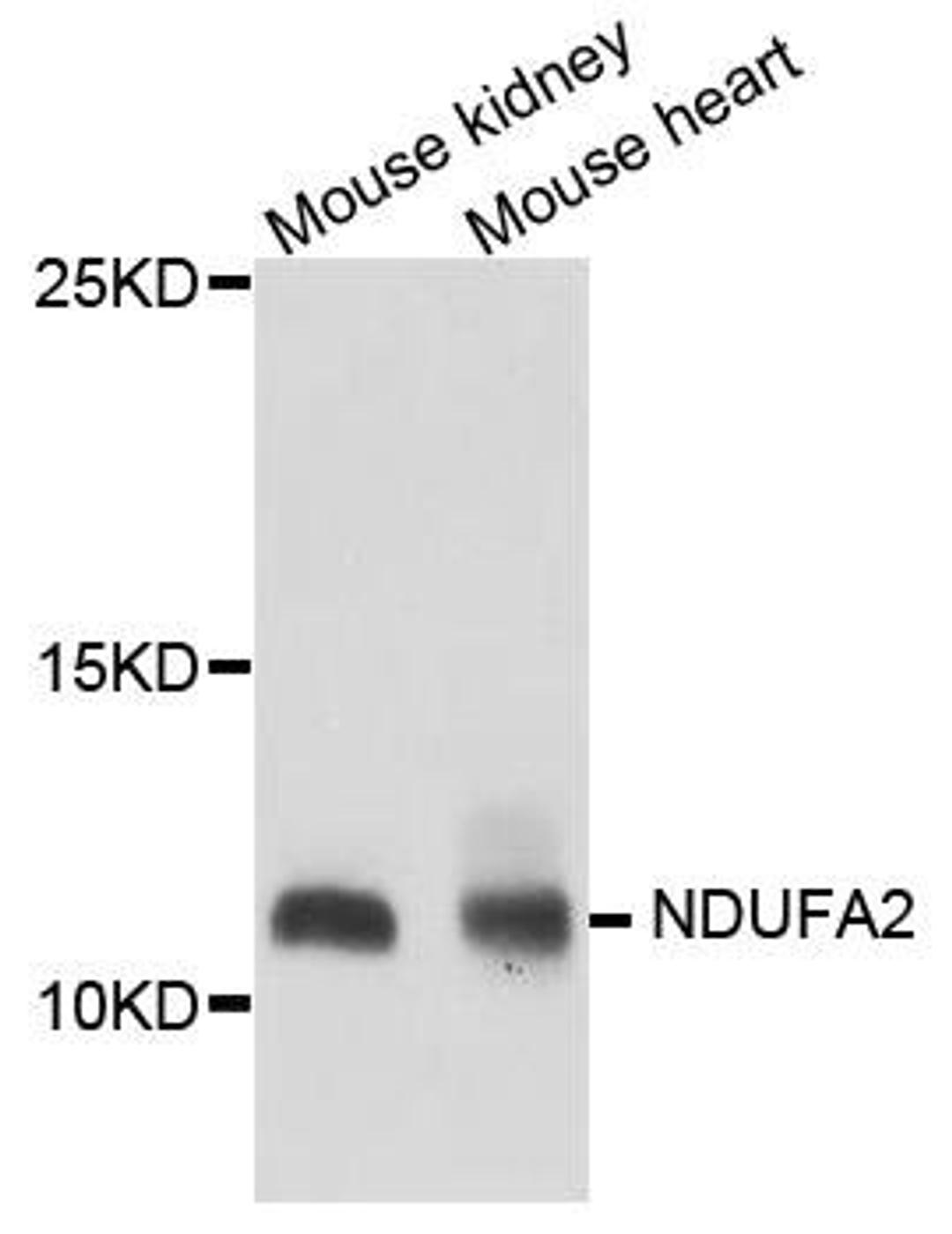 Western blot analysis of extract of various cells using NDUFA2 antibody