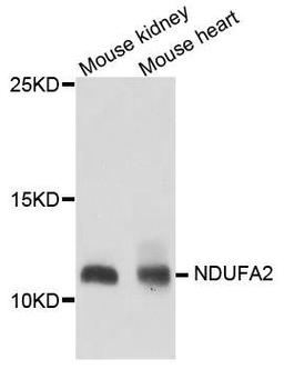 Western blot analysis of extract of various cells using NDUFA2 antibody