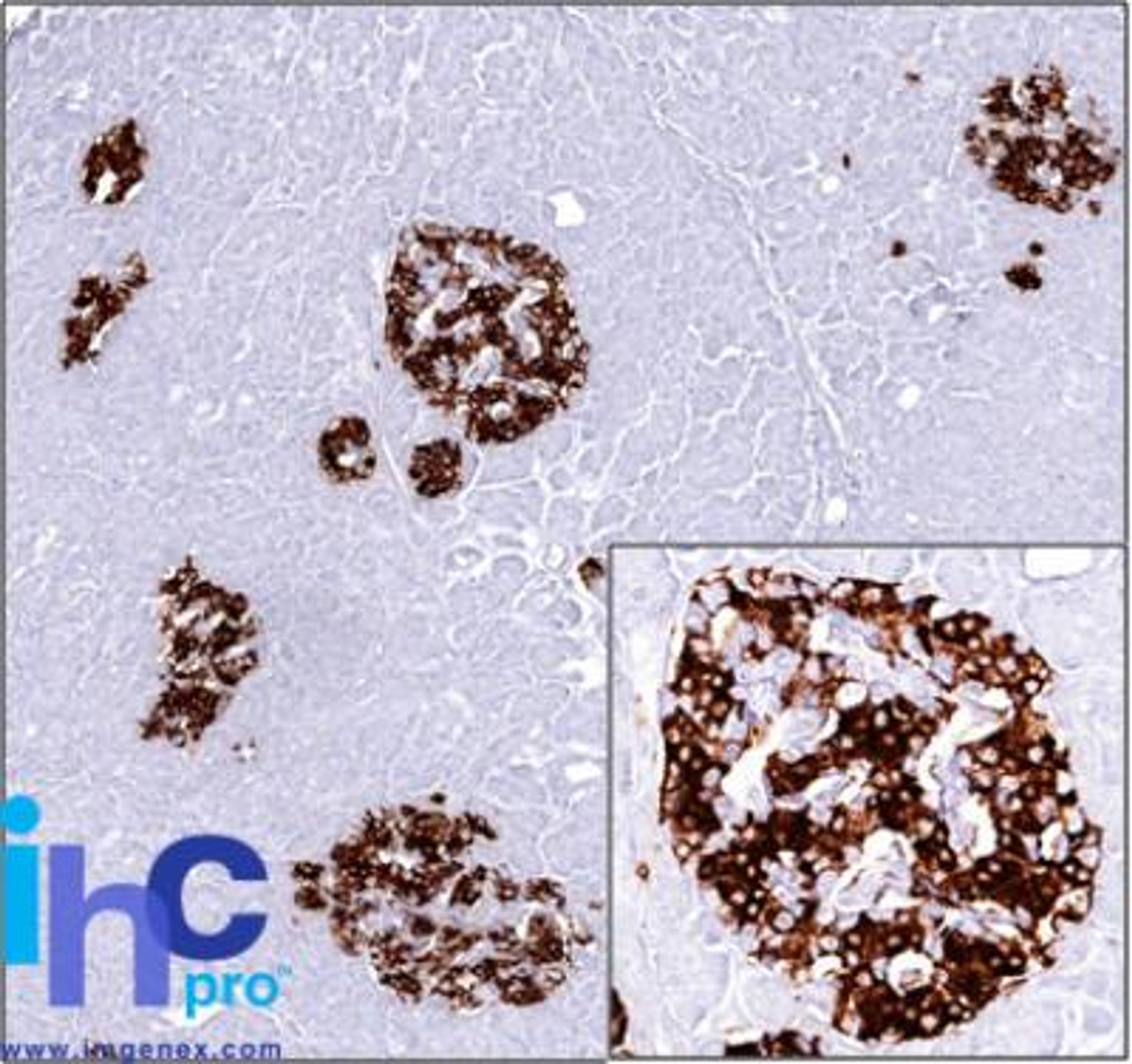 Immunohistochemistry-Paraffin: Insulin Antibody (2D11-H5) [NBP2-15195] - Analysisof Insulin in formalin-fixed paraffin embedded human pancreas using Insulin antibody (1:500), peroxidase-conjugate and DAB chromogen. Note the cytoplasmic staining of cells.