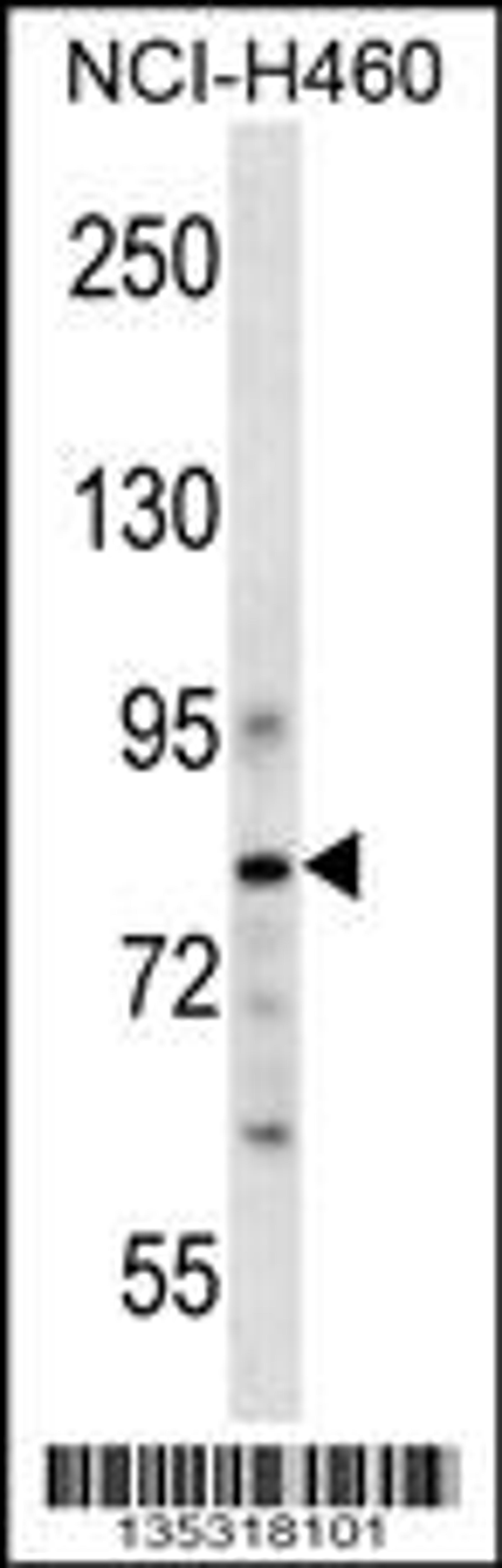 Western blot analysis in NCI-H460 cell line lysates (35ug/lane).