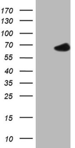 Western Blot: POTEG Antibody (2G1) [NBP2-45372] - Analysis of HEK293T cells were transfected with the pCMV6-ENTRY control (Left lane) or pCMV6-ENTRY POTEG.