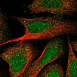 Immunocytochemistry/Immunofluorescence: ZCCHC4 Antibody [NBP1-82094] - Staining of human cell line U-2 OS shows positivity in nucleus, plasma membrane & cytoplasm.