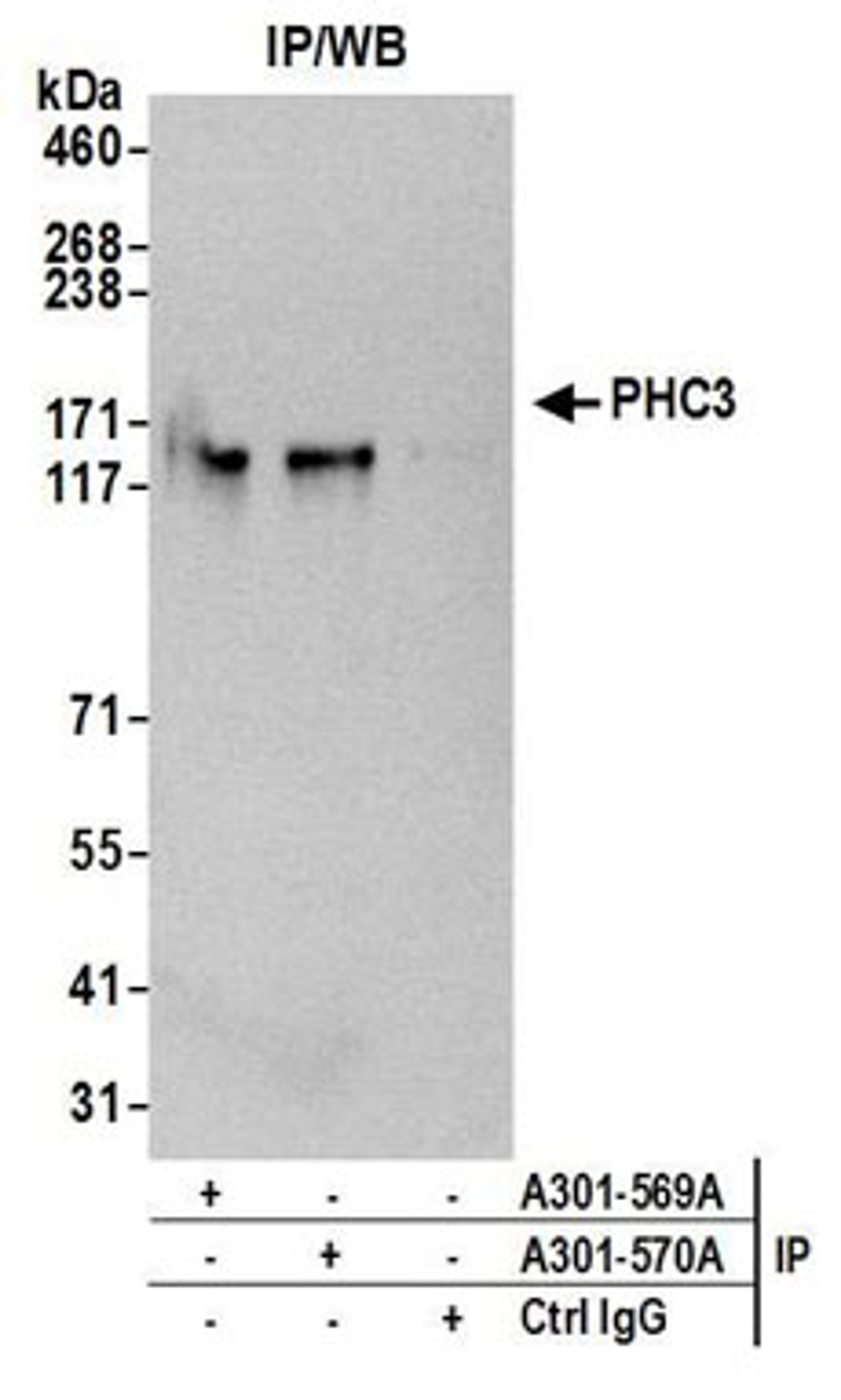 Detection of human PHC3 by western blot of immunoprecipitates.