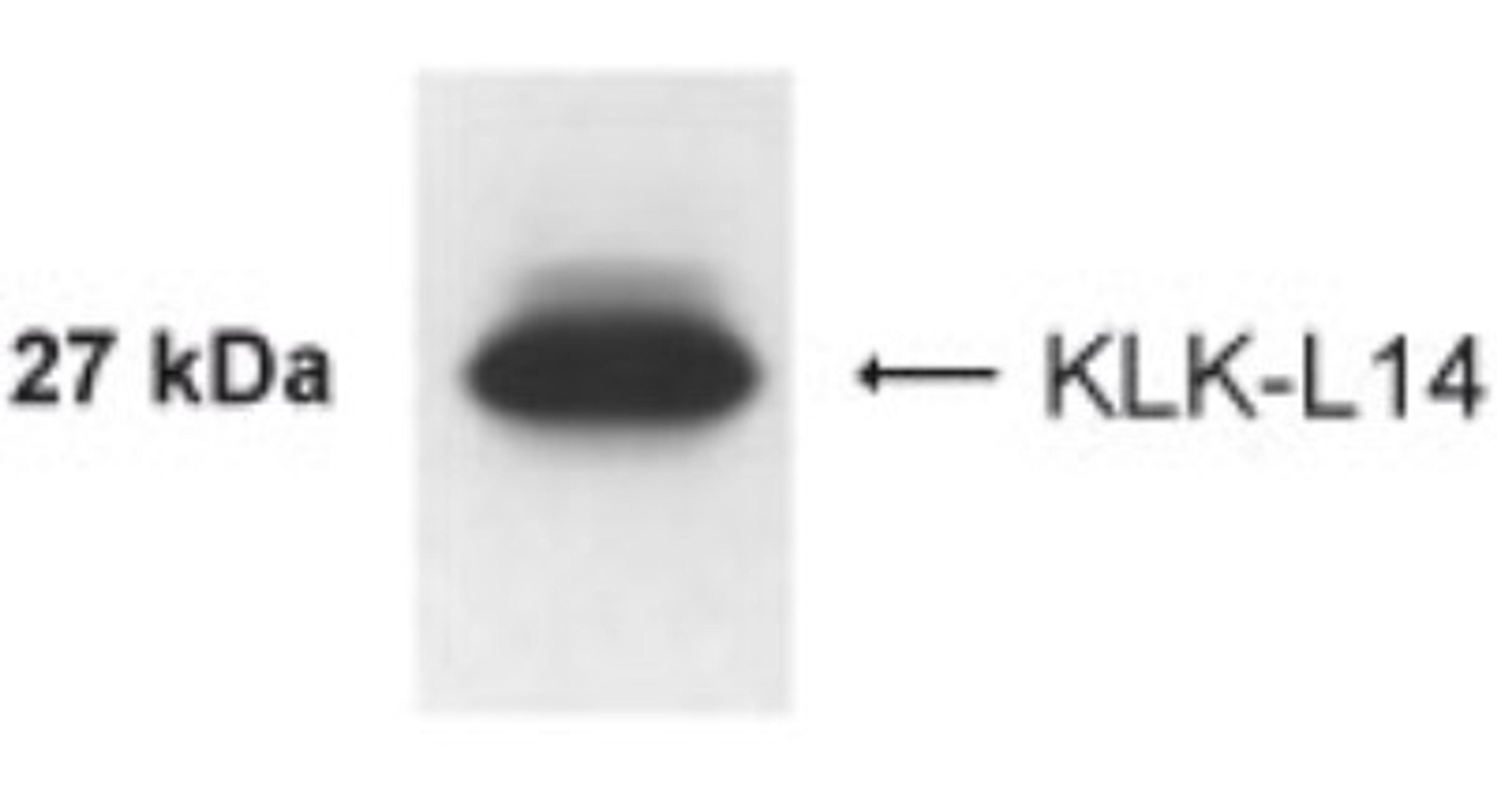 Western Blot: Kallikrein 14 Antibody [NB200-132] - Analysis of Kallikrein 14 in BT-474 cells using this antibody at 1:1000 dilution