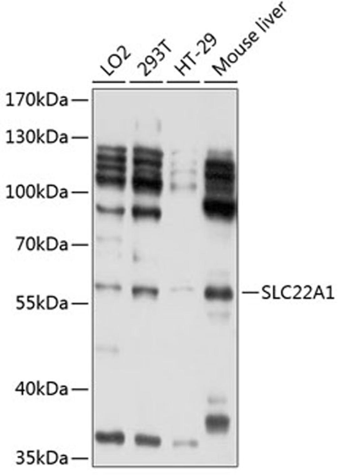 Western blot - SLC22A1 antibody (A1739)