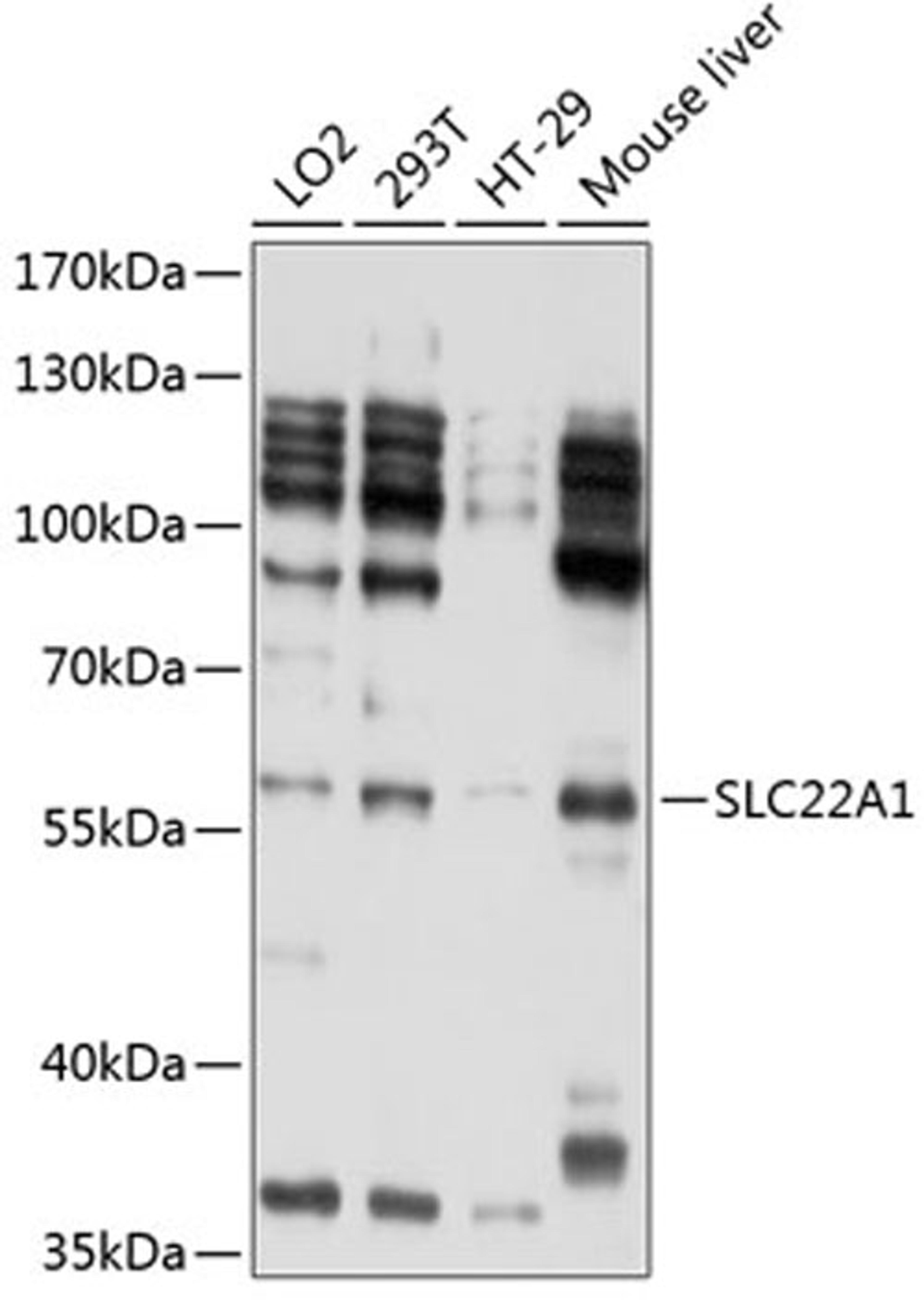 Western blot - SLC22A1 antibody (A1739)