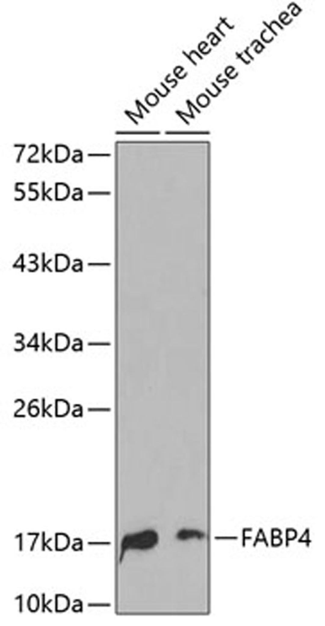 Western blot - FABP4 antibody (A0232)