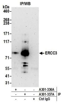 Detection of human ERCC3 by western blot of immunoprecipitates.