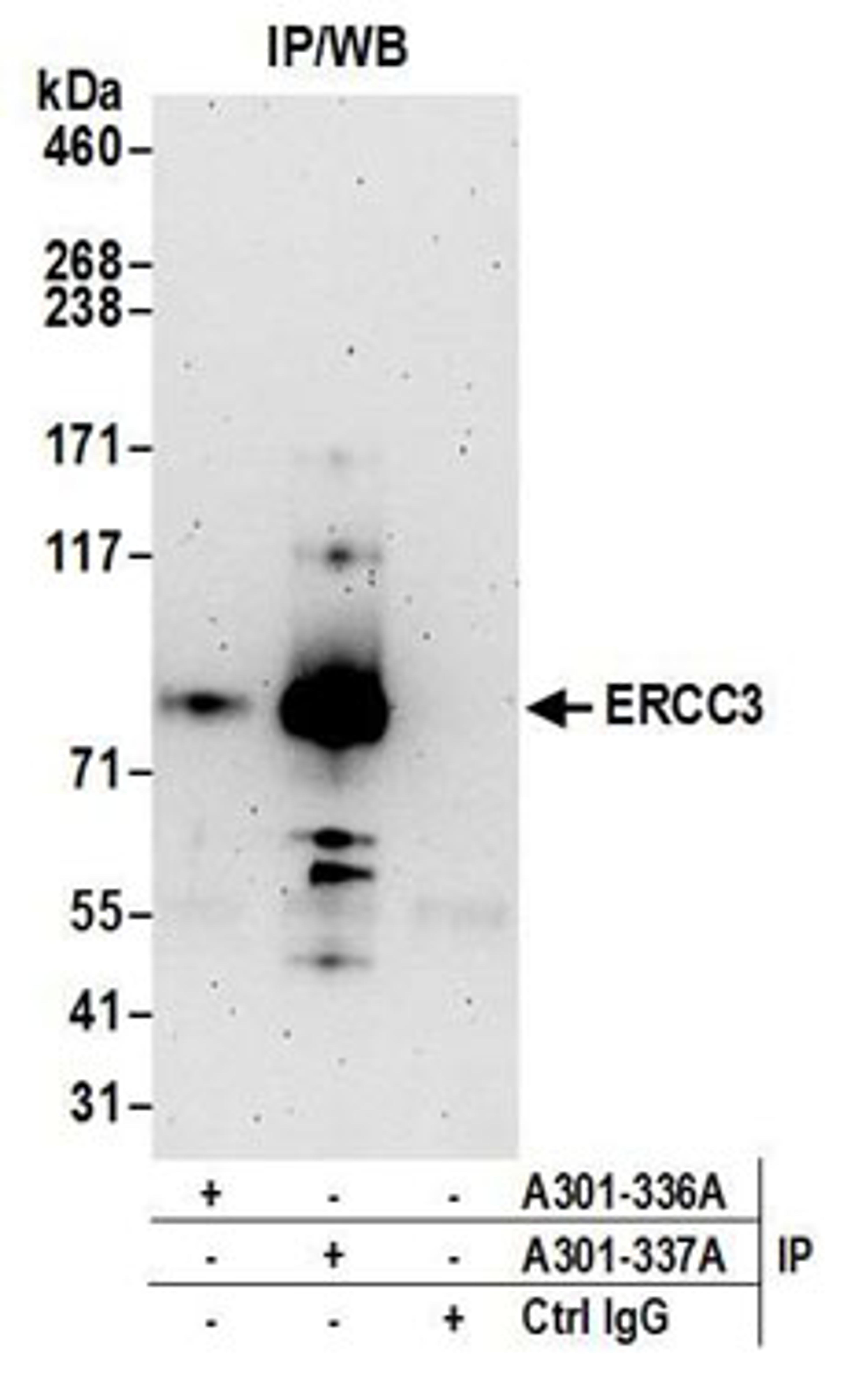 Detection of human ERCC3 by western blot of immunoprecipitates.