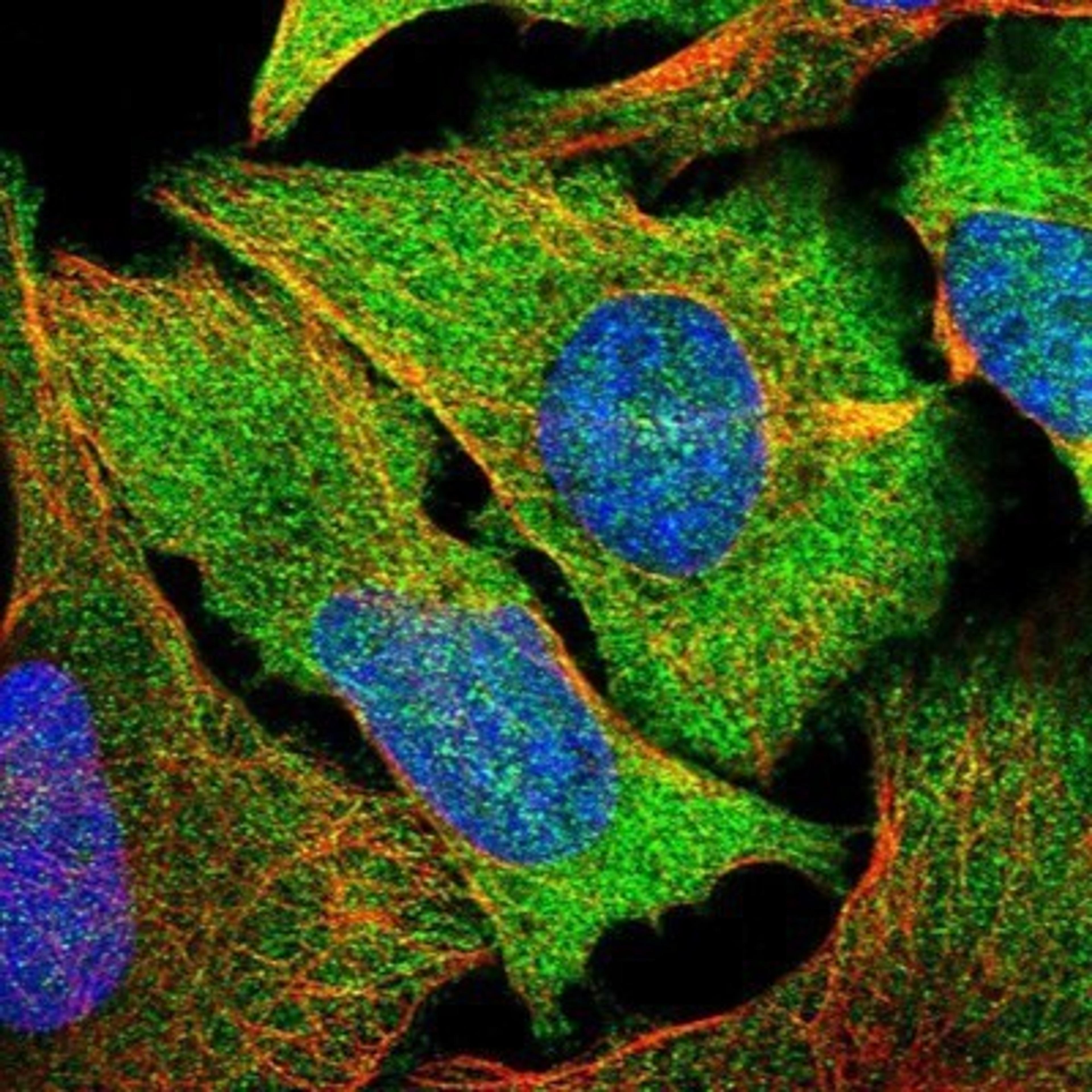 Immunocytochemistry/Immunofluorescence: Autoimmune Regulator/AIRE Antibody [NBP1-89046] - Staining of human cell line U-2 OS shows positivity in nucleus but not nucleoli, plasma membrane, cytoplasm & cytoskeleton (actin filaments).