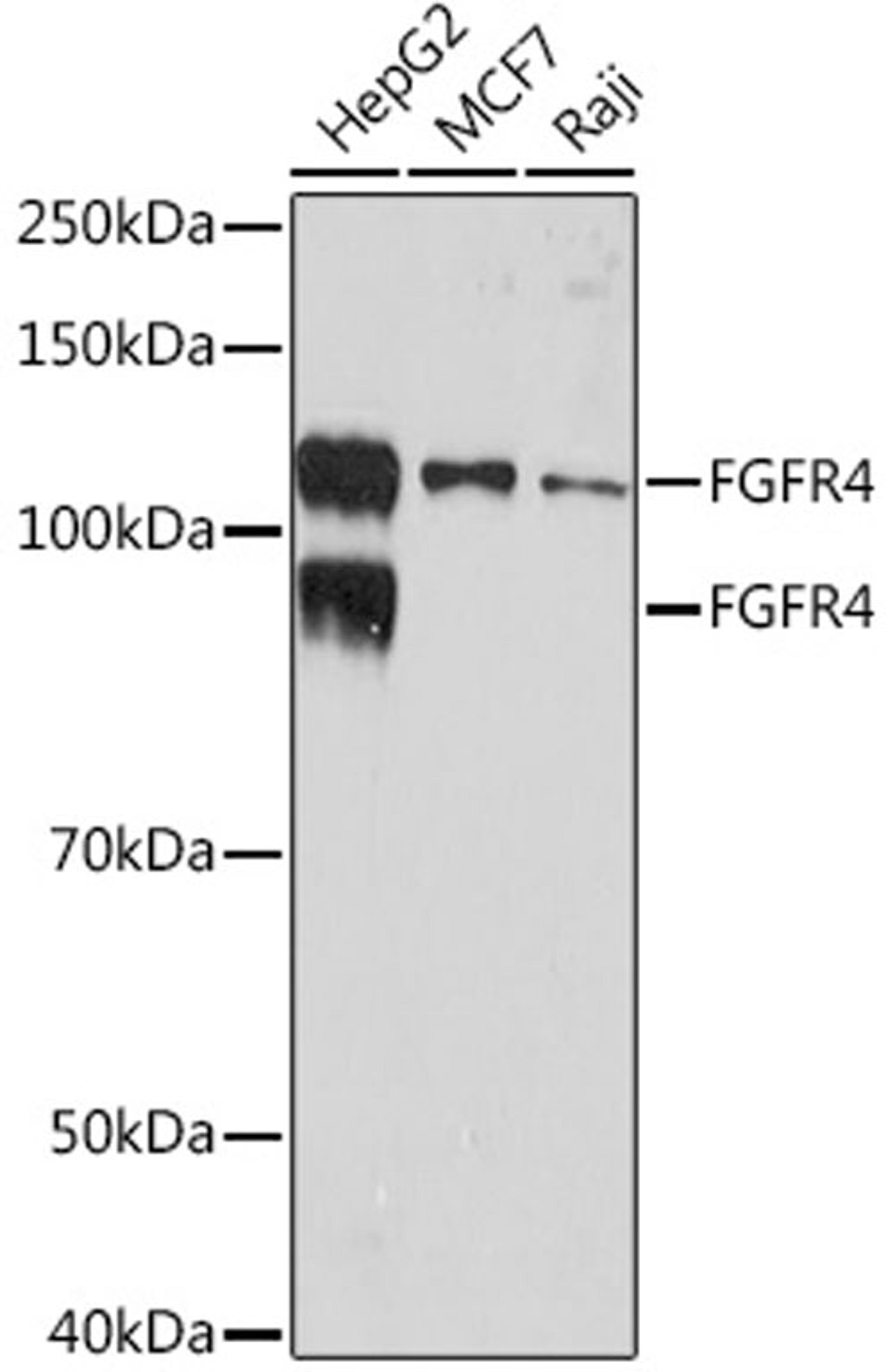 Western blot - FGFR4 Rabbit mAb (A9197)