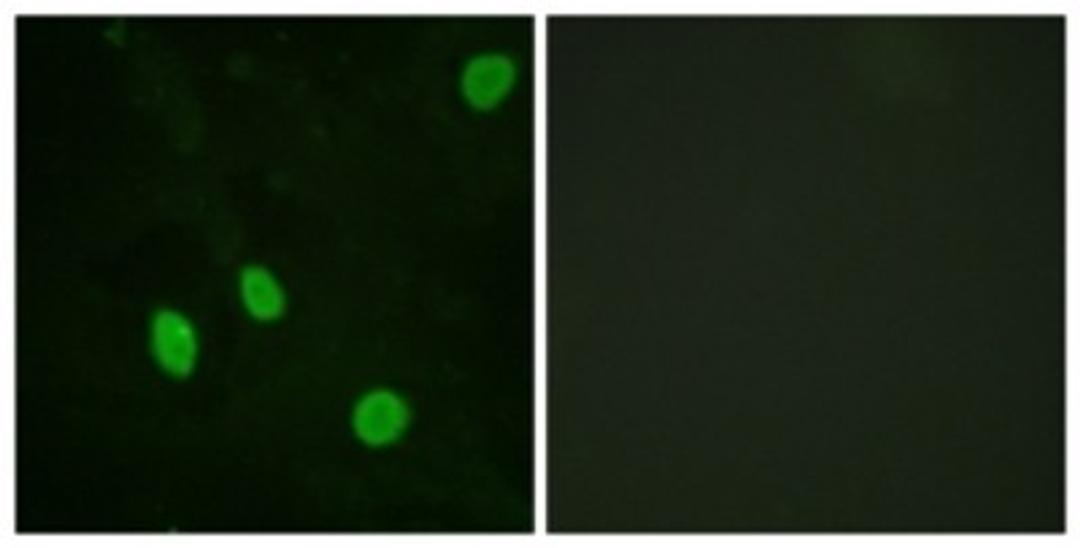 Immunocytochemistry/Immunofluorescence: Cyclin H Antibody [NBP1-61584] - Analysis of HeLa cells, using Cyclin H  Antibody. The picture on the right is treated with the synthesized peptide.