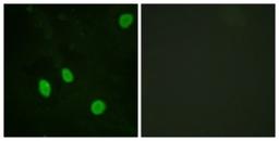 Immunocytochemistry/Immunofluorescence: Cyclin H Antibody [NBP1-61584] - Analysis of HeLa cells, using Cyclin H  Antibody. The picture on the right is treated with the synthesized peptide.