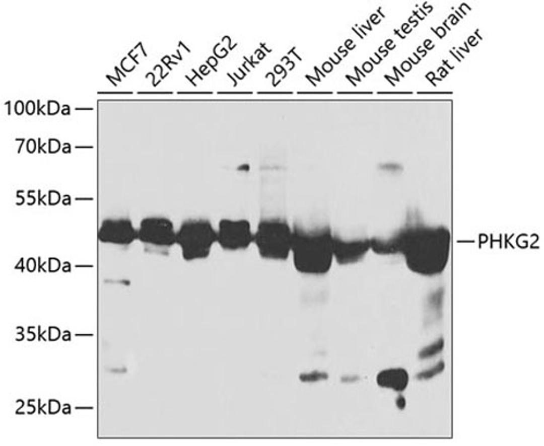 Western blot - PHKG2 antibody (A14040)