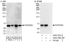 Detection of human FASTKD2 by western blot and immunoprecipitation.