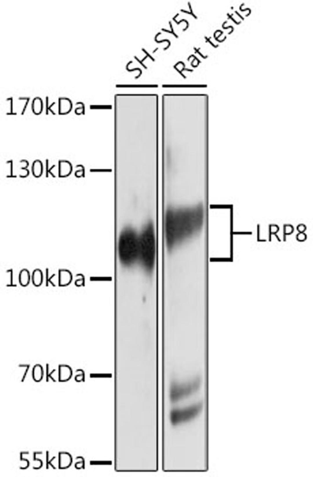 Western blot - LRP8 antibody (A10517)