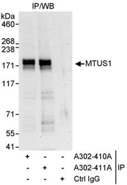 Detection of human MTUS1 by western blot of immunoprecipitates.