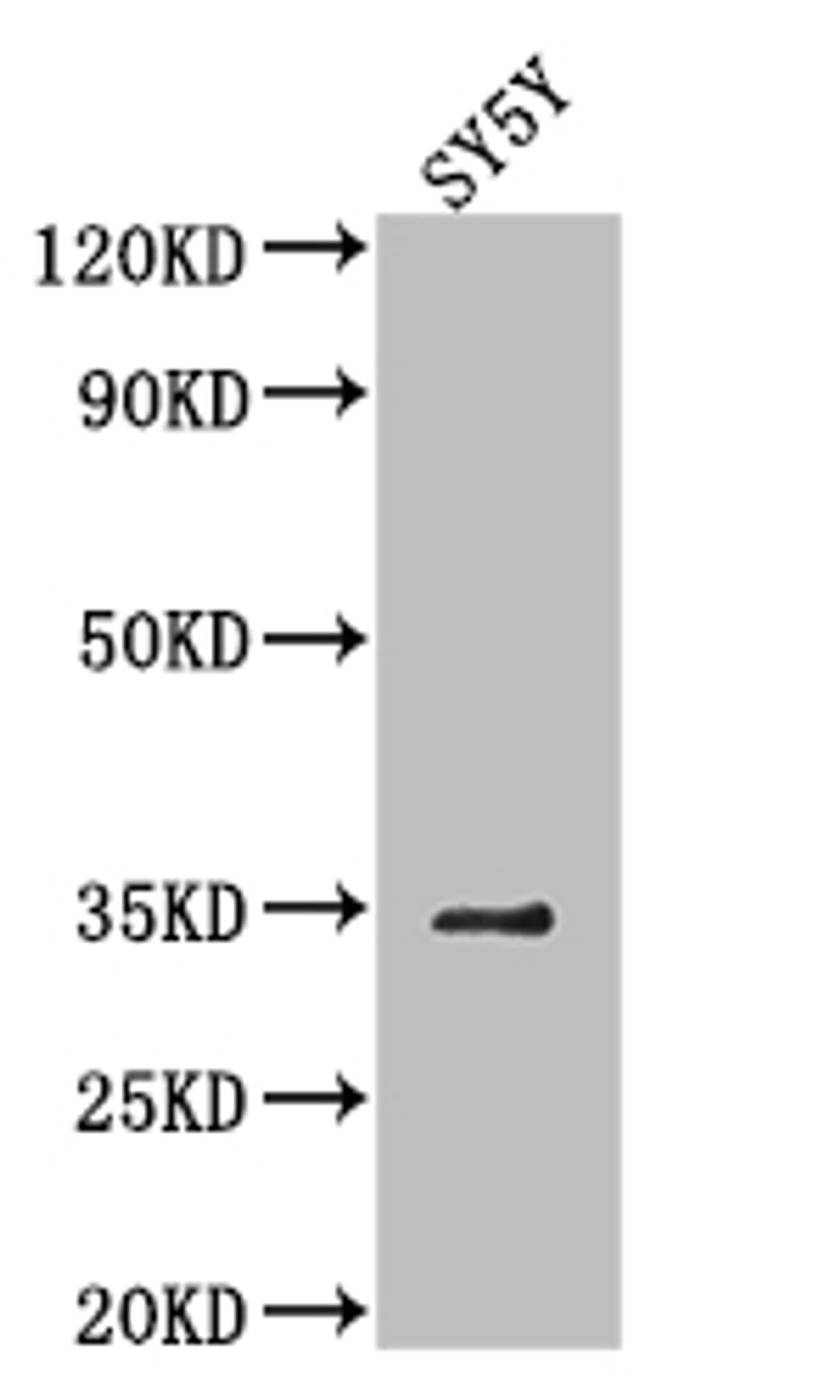 Western Blot. Positive WB detected in: SH-SY5Y whole cell lysate. All lanes: VASH2 antibody at 1:2000. Secondary. Goat polyclonal to rabbit IgG at 1/50000 dilution. Predicted band size: 41, 34, 19, 36, 30 kDa. Observed band size: 34 kDa. 